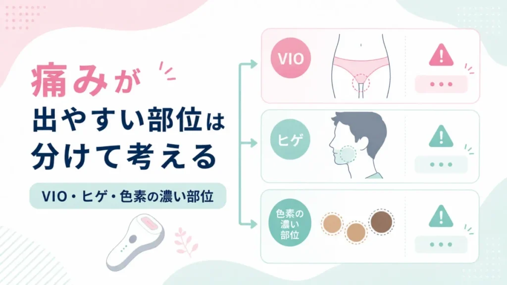 VIO・ヒゲ・色素の濃い部位を分けて、痛みが出やすい箇所を整理する図解