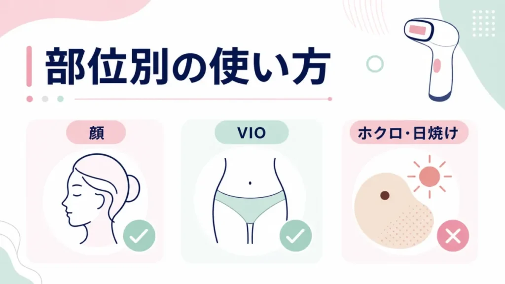 ケノンの部位別の使い方と避ける部位を顔やVIOなどで整理する図解