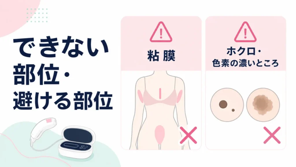 ケノンで避ける部位として粘膜やホクロ、色素の濃い部分を示した注意点の図解