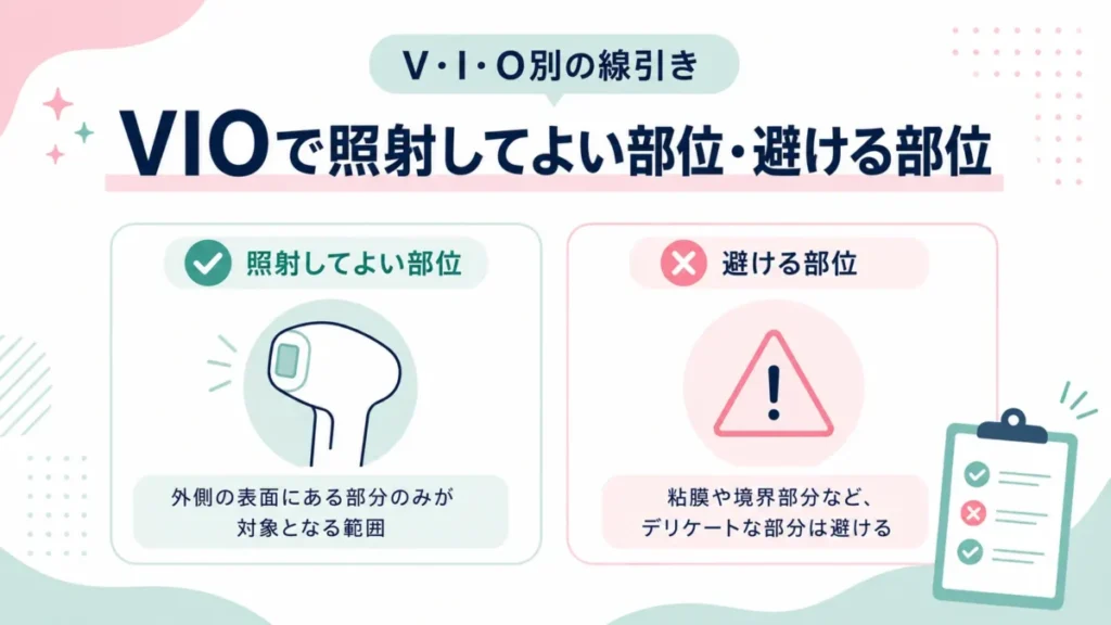 VIOで照射してよい部位と避ける部位の線引きを整理する図解